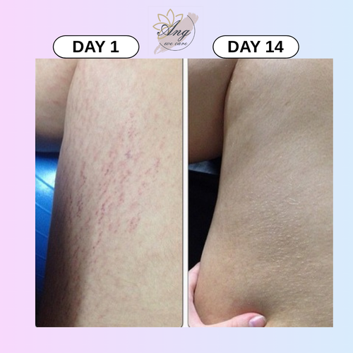ANG Body Scrub — Candy