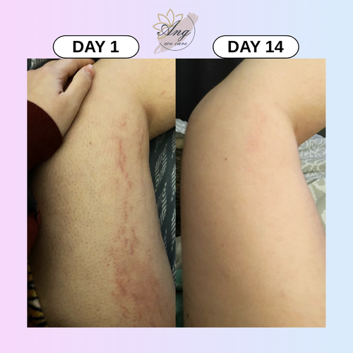 ANG Body Scrub — Candy