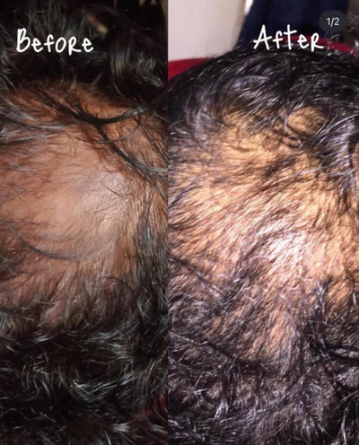 Burdock oil with red pepper